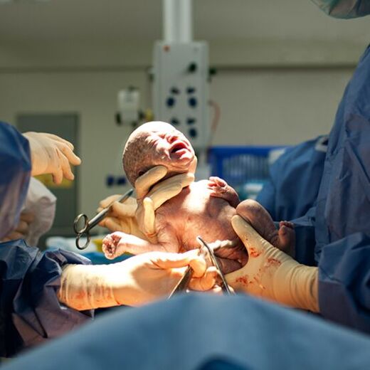 תמונה של תינוק שרק נולד בחדר בית החולים